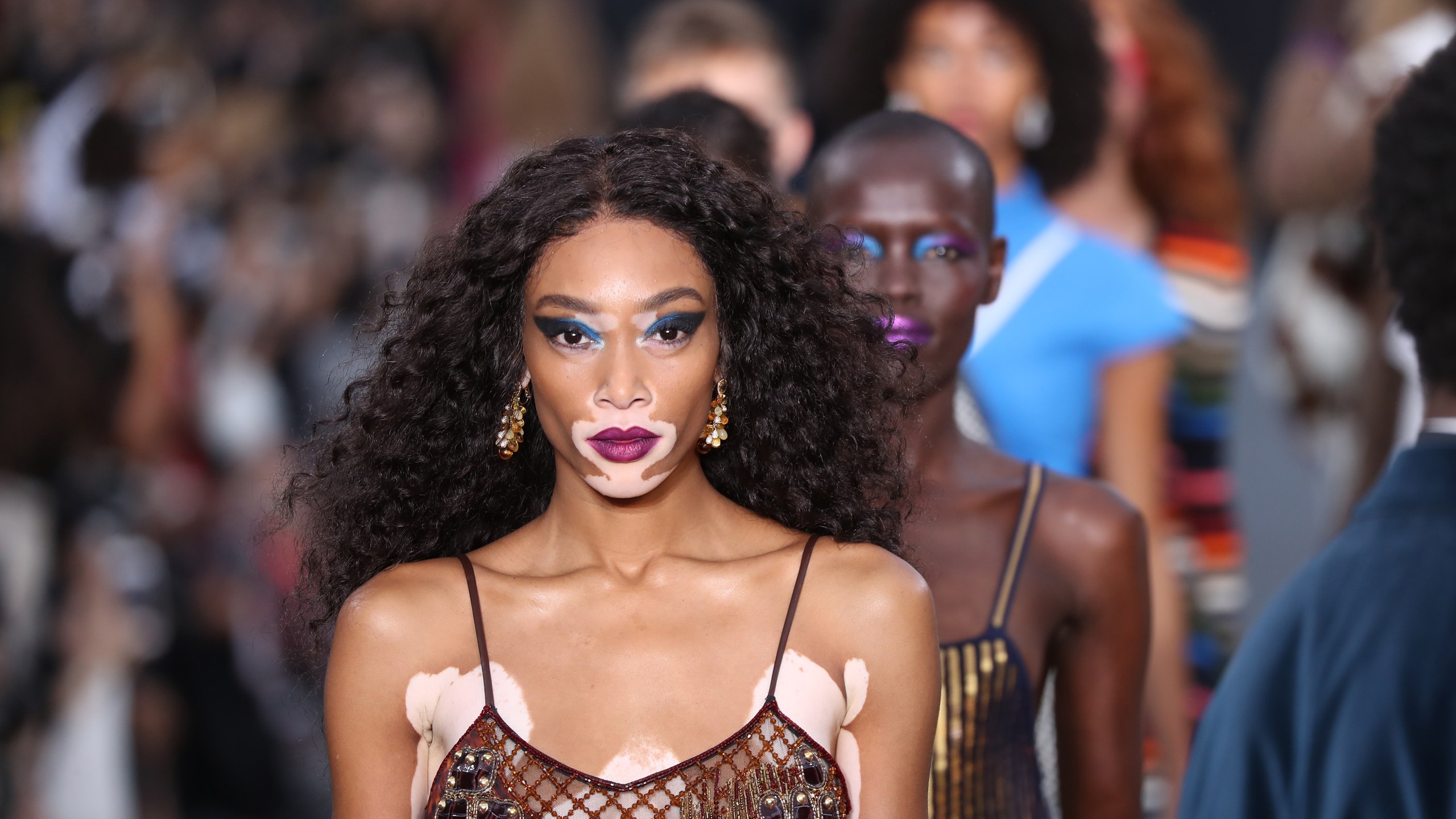 Winnie Harlow Says America S Next Top Model Didn T Do Anything