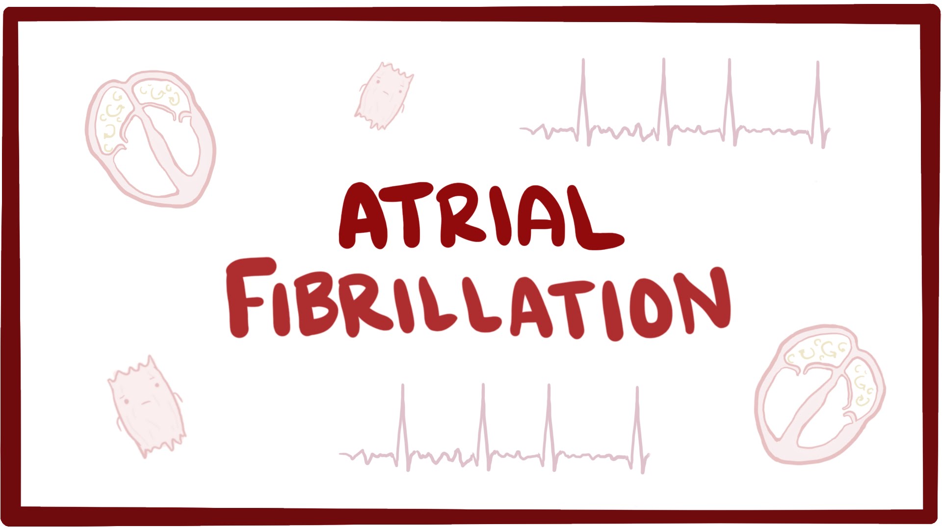 Atrial Fibrillation Video Anatomy Definition Osmosis