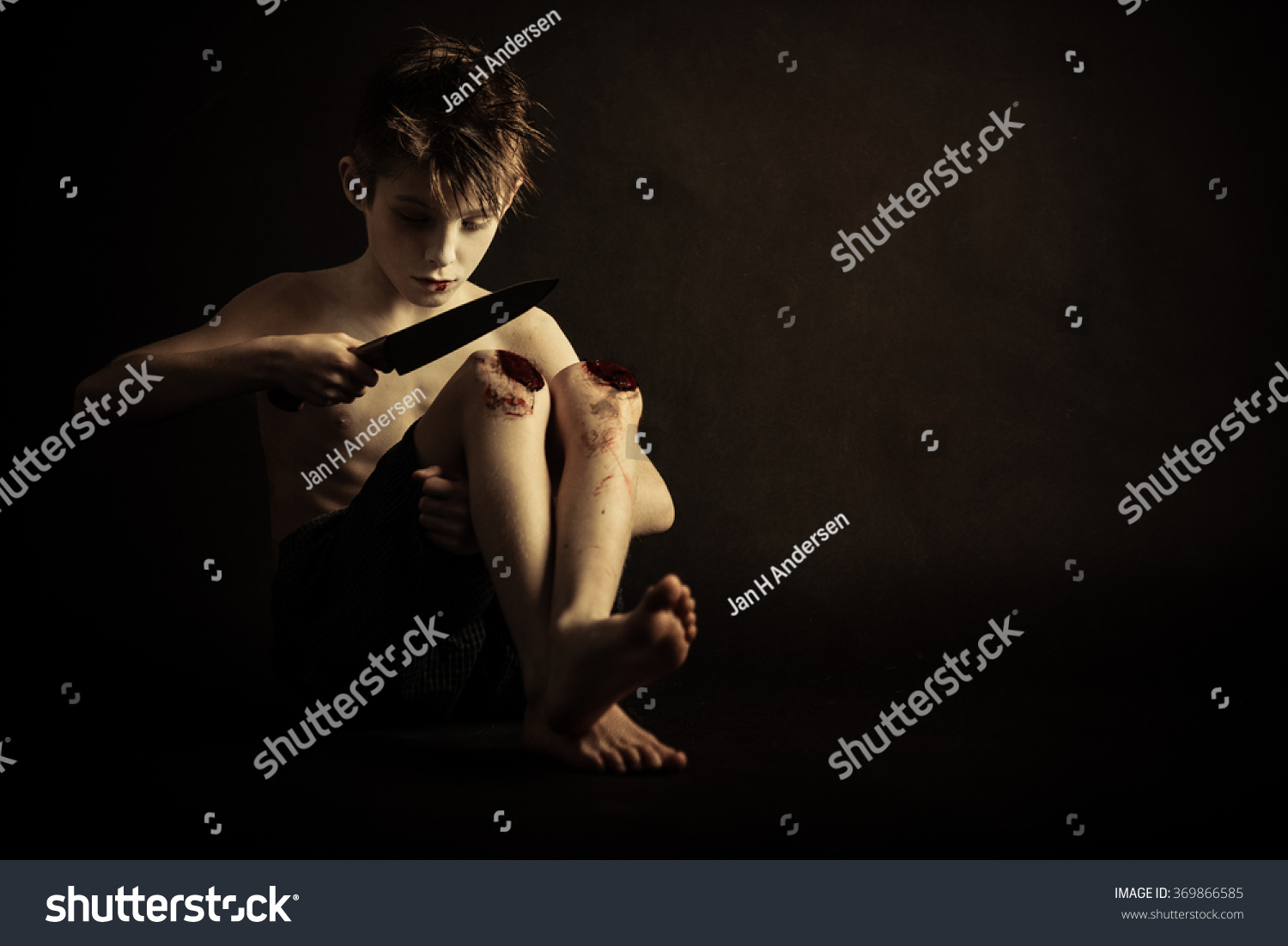 Psychotic Young Boy Wounds On His Stock Photo Edit Now