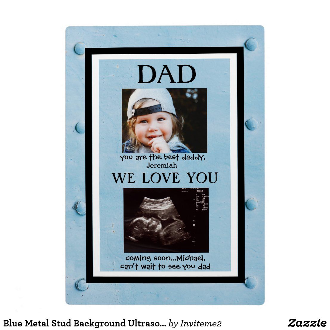 Blue Metal Stud Background Ultrasound Photo Plaque
