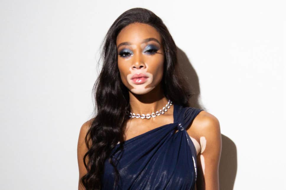 Winnie Harlow Is The Amazonian Model To Join Victoria S