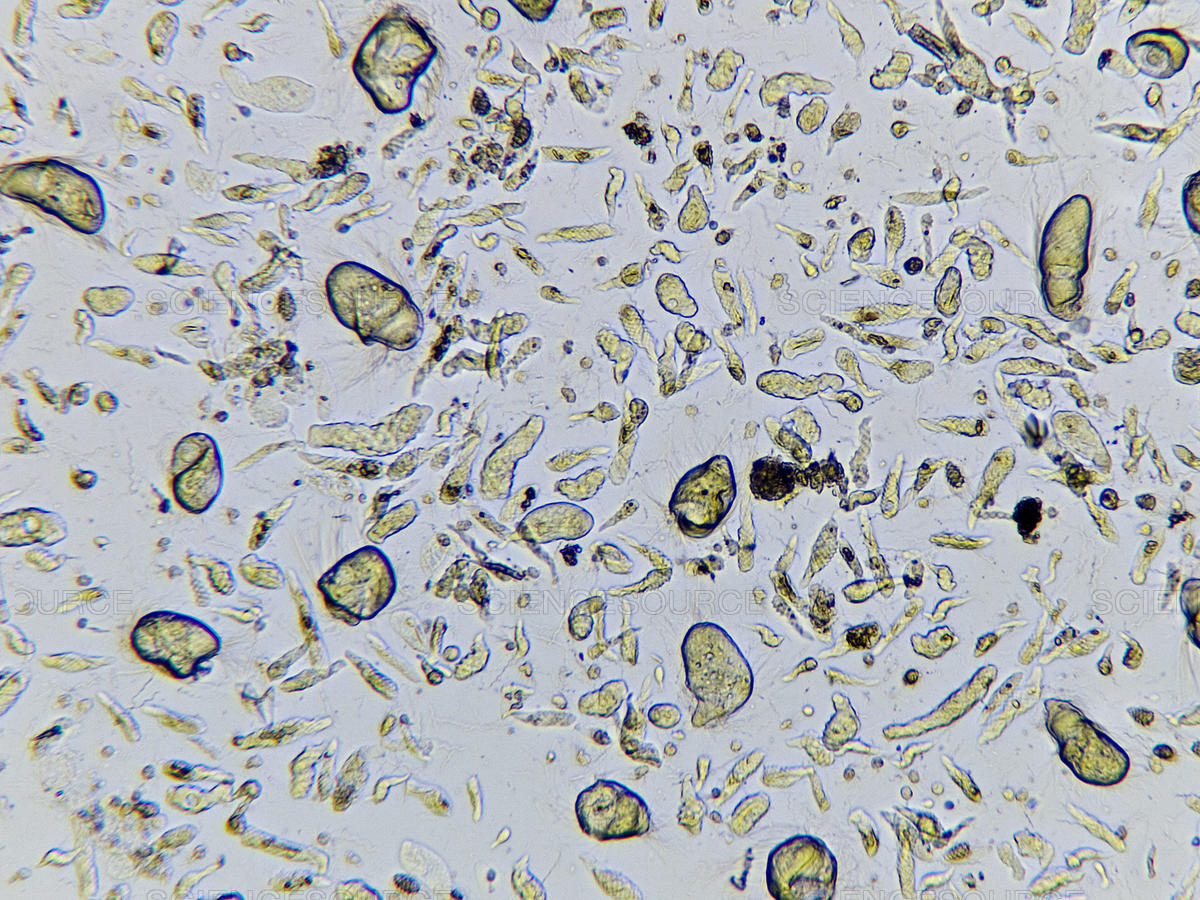 Science Source Symbiotic Protozoa In Termite Gut Lm