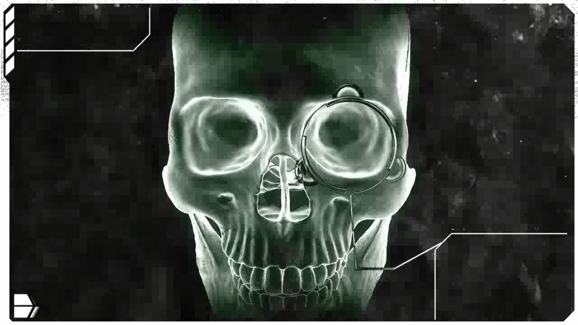 Human Skull X Ray wallpaper   224381