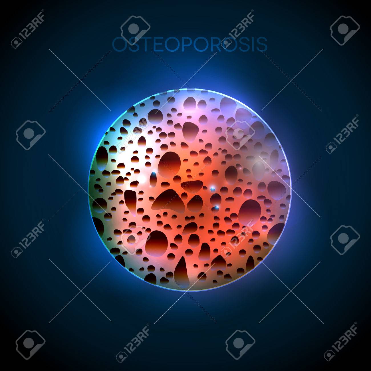 Osteoporosis Round Illustration On A Abstract Blue Background