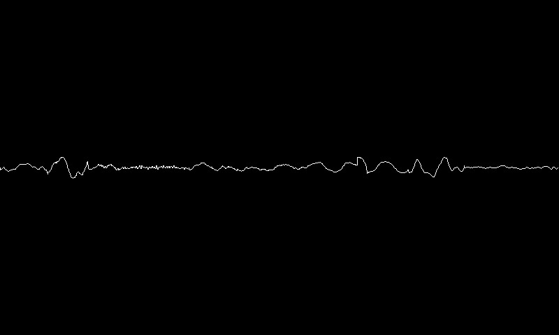 The Sound Wave Of Whatever It Hears You Can See What Looks Like