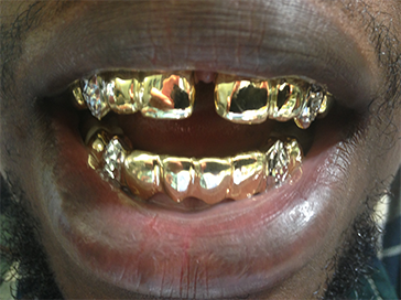 Grillz