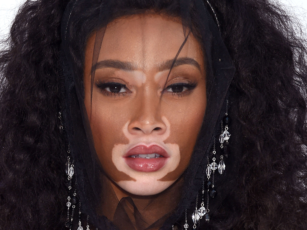 Winnie Harlow It S Beautiful That The Age Of Cookie Cutter