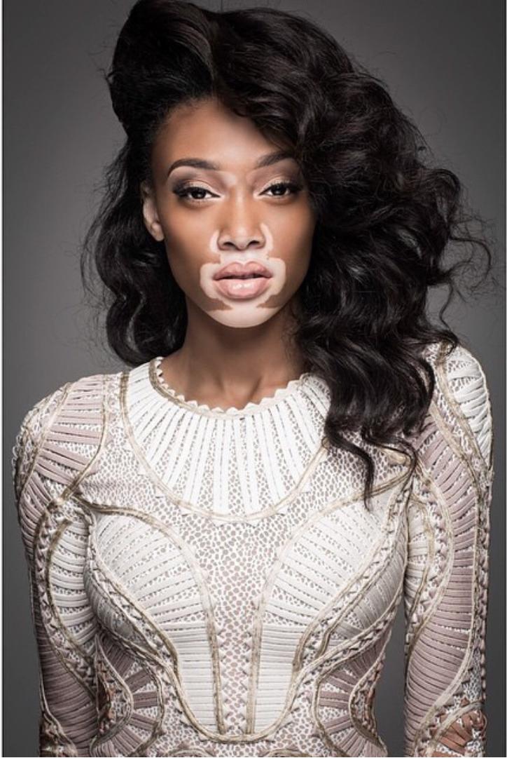 Beauty Es In All Different Colors The Flawless Winnie Harlow