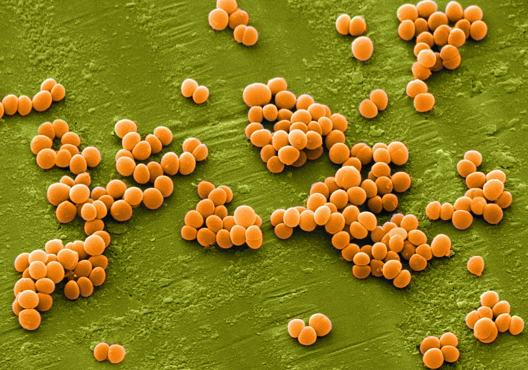 Streptococcus Bacteria HD Wallpaper Background