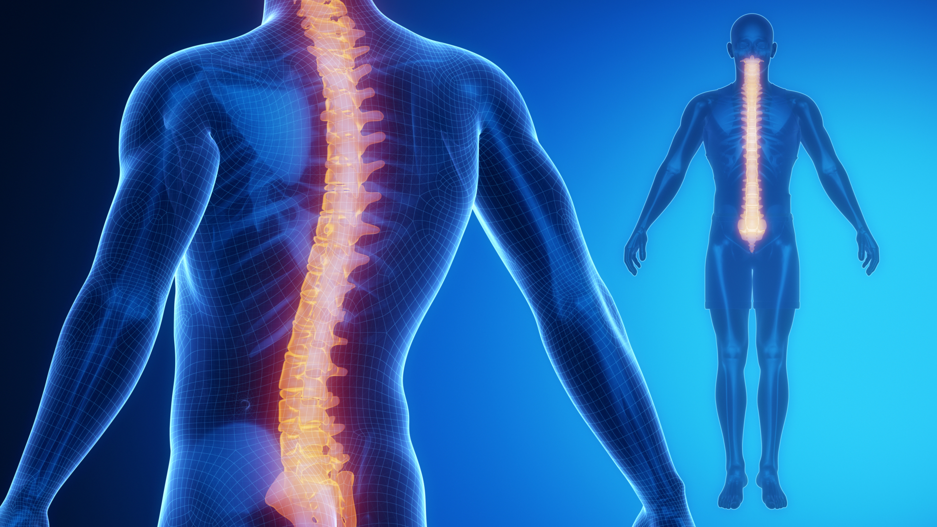 Scoliosis And Deformity Treatment Orange County Neurosurgical