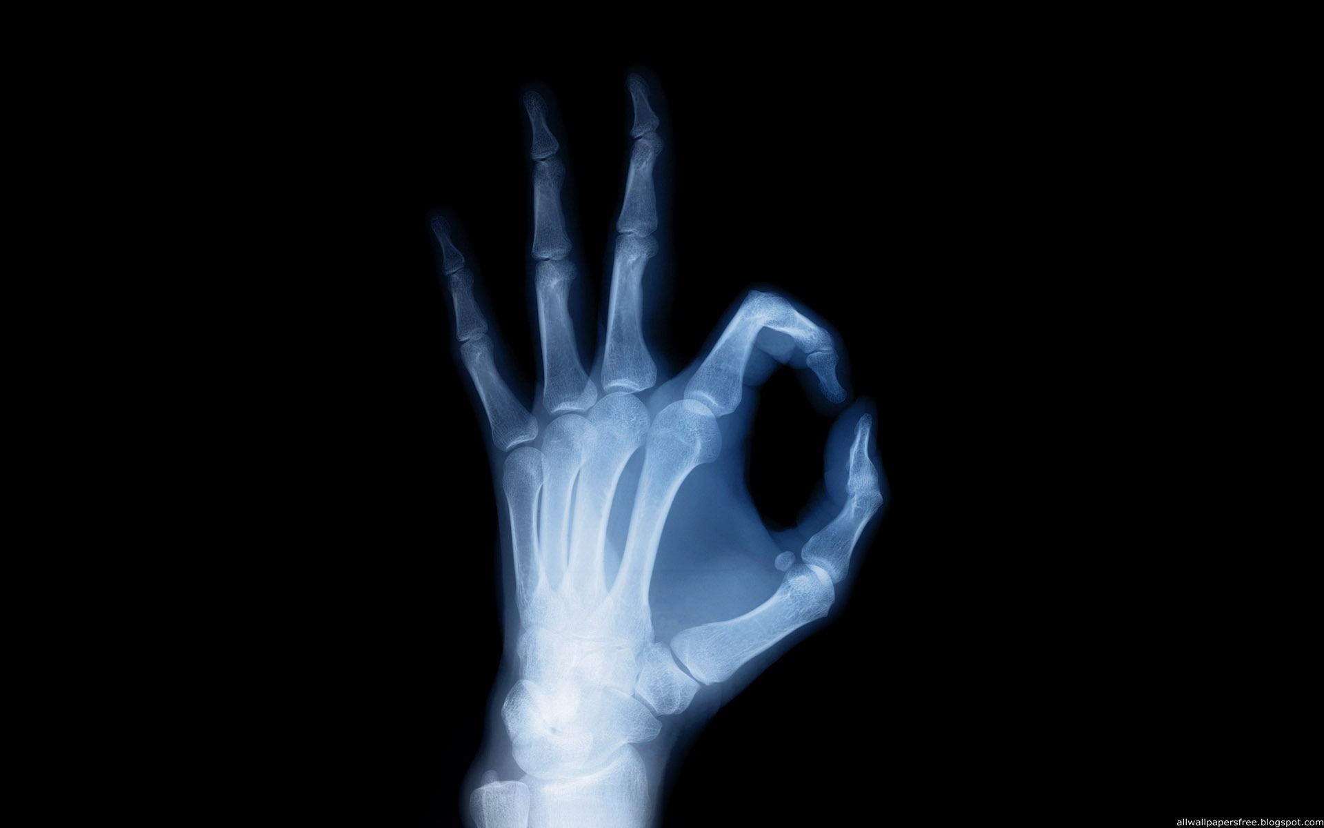X Rays Texture Background Photo Arm Ray