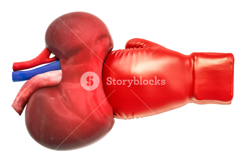 Pain In Kidneys Chronic Kidney Disease Concept With