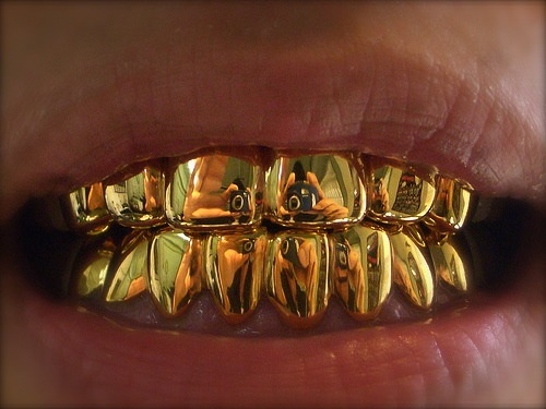 14k Solid Gold Grill 8pc Teeth Molding Kit