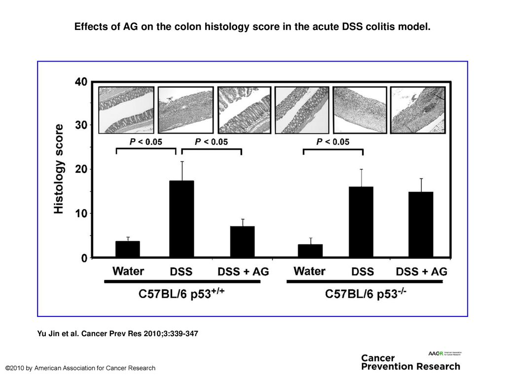 Effects of AG on the colon histology score in the acute DSS