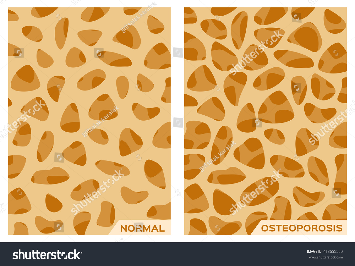 Osteoporosis Strong Bone Background Vector Stock Royalty