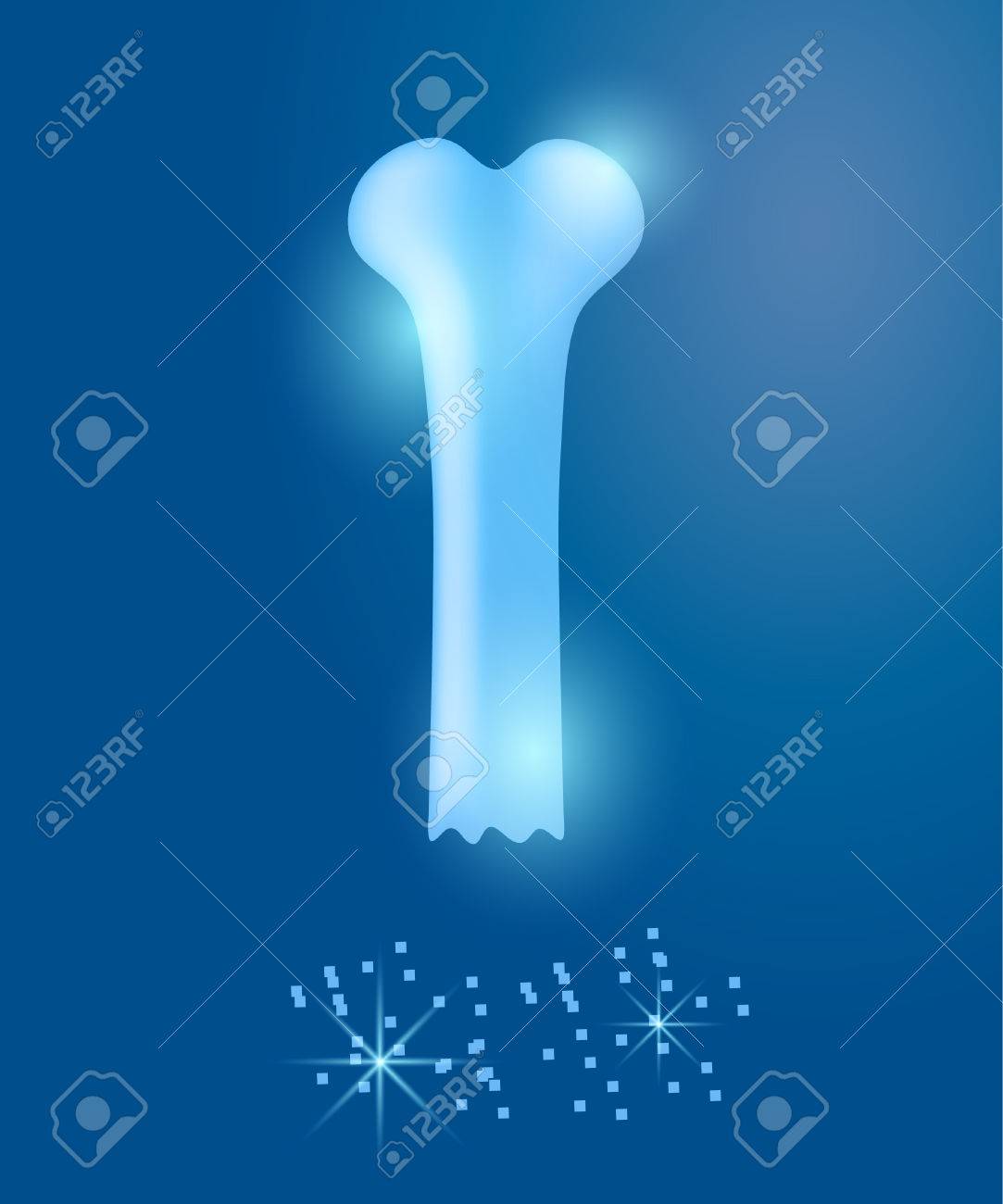 Osteoporosis On A Blue Background Royalty Cliparts Vectors