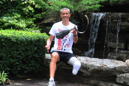 Gallery Terry Fox Prosthetic Leg