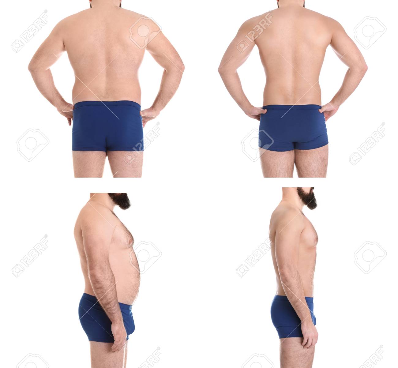 Overweight Man Before And After Weight Loss On White Background