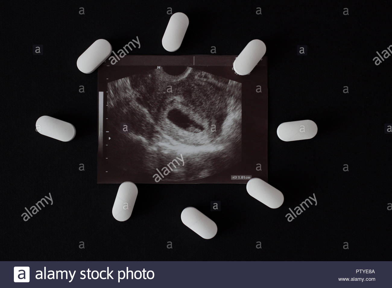 Uzi Pregnancy Tablets And Abortion Black Background Stock Photo