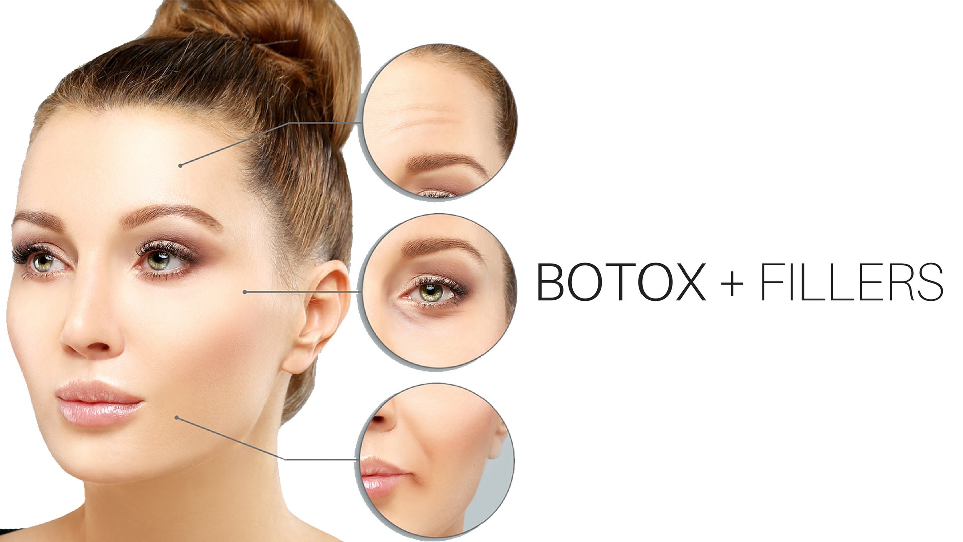 Botox Apex Md