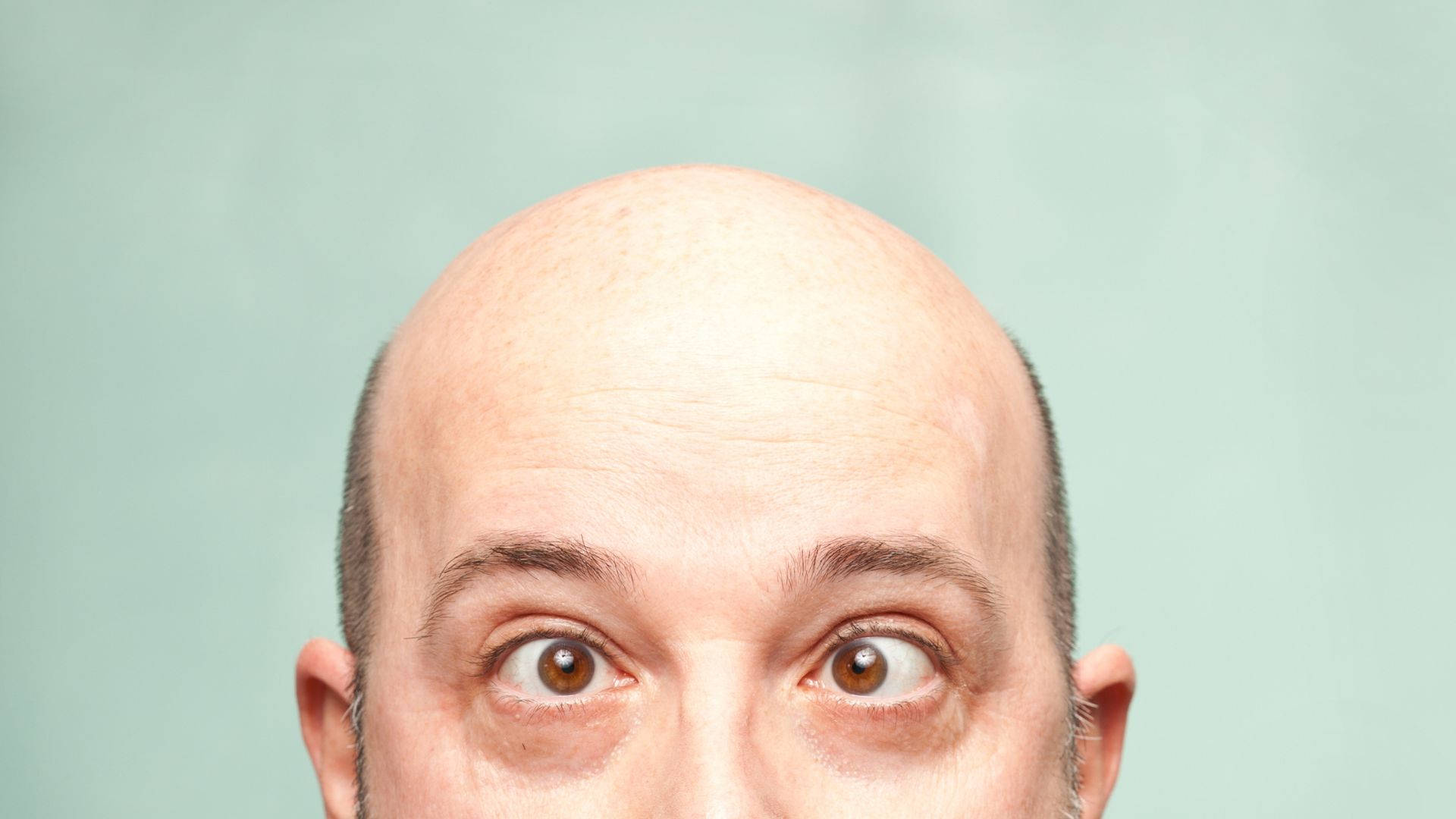 Bald Man With Crossed Eyes Wallpaper