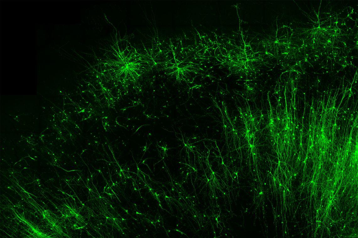 New Rna Based Tool Can Illuminate Brain Circuits Edit Specific