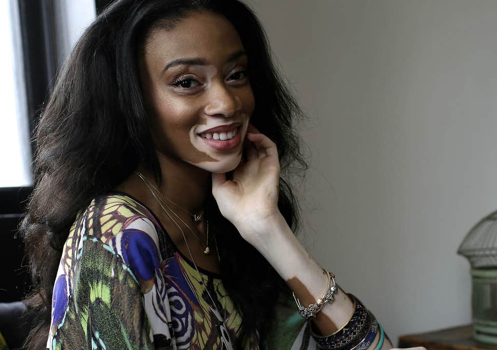Winnie Harlow Everything You Need To Know About The Star Of