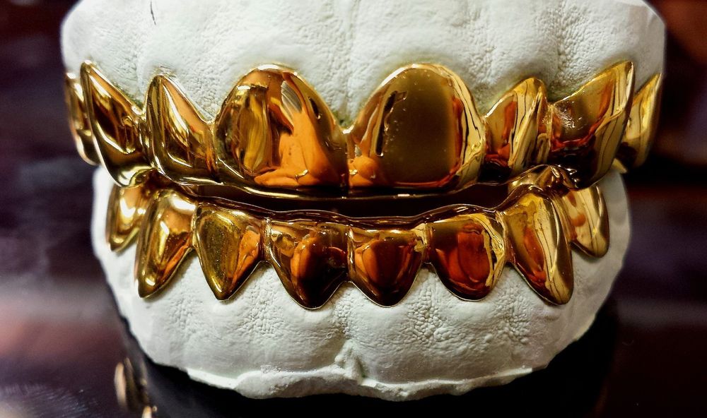 10k Solid Yellow Gold Custom Fit 6pc Real Grill Grillz