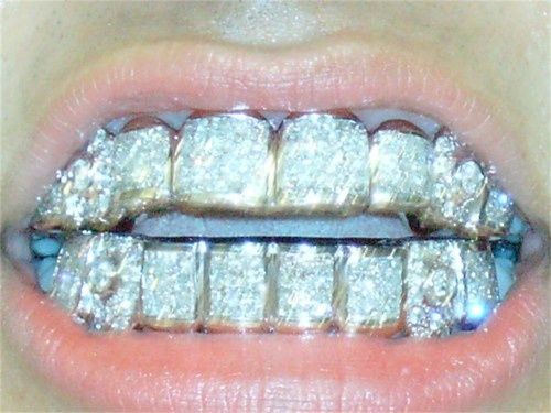 Image About Top And Bottom Grillz