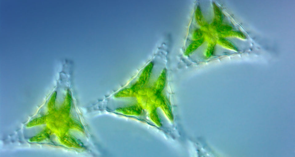 Light Micrograph Image Of Green Algae Staurastrum Visuals Unlimited
