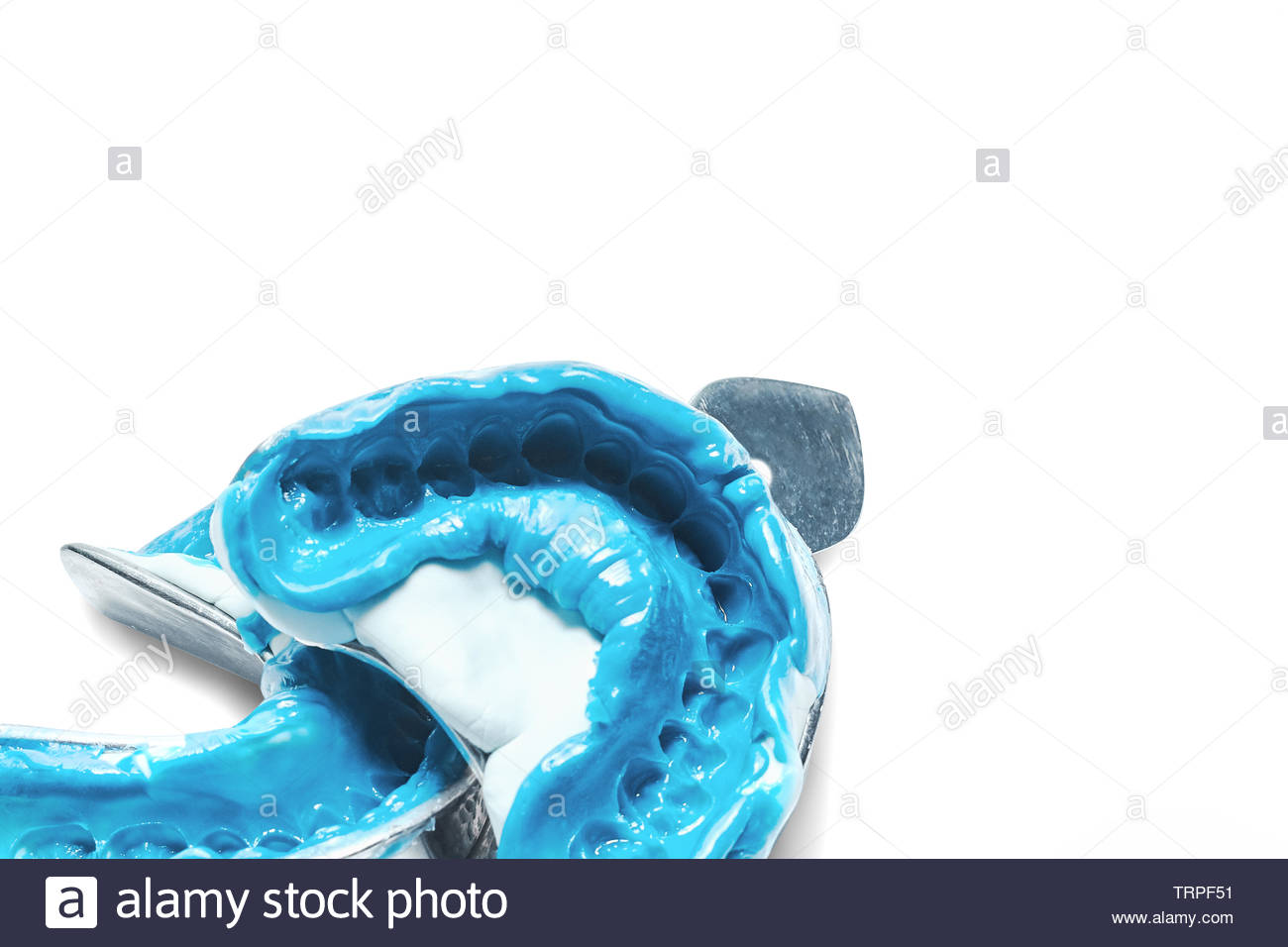 Two Dental Impressions On A White Background With Copy Space