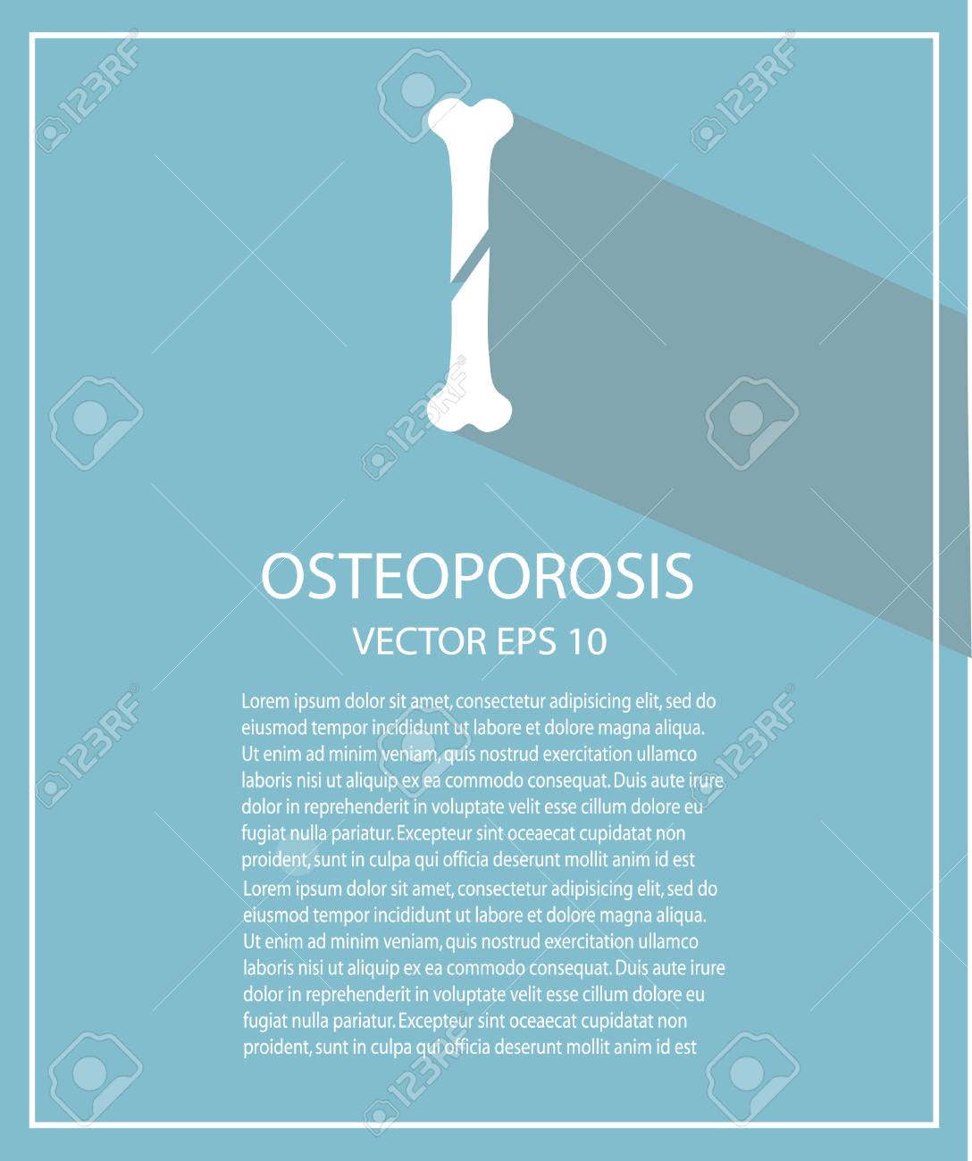 Osteoporosis Background Royalty Cliparts Vectors And Stock