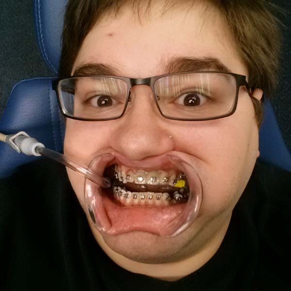 Funny Man Selfie At Dentist Pics People Crazy Selfies Dental Ment