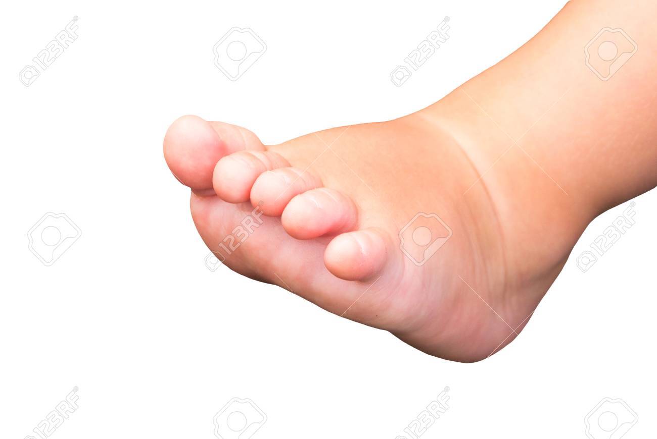 Baby Foot Isolated On White Background Little Baby Feet With
