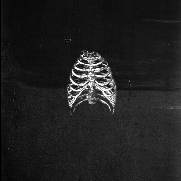 Skeleton Background Of A Ribcage Then