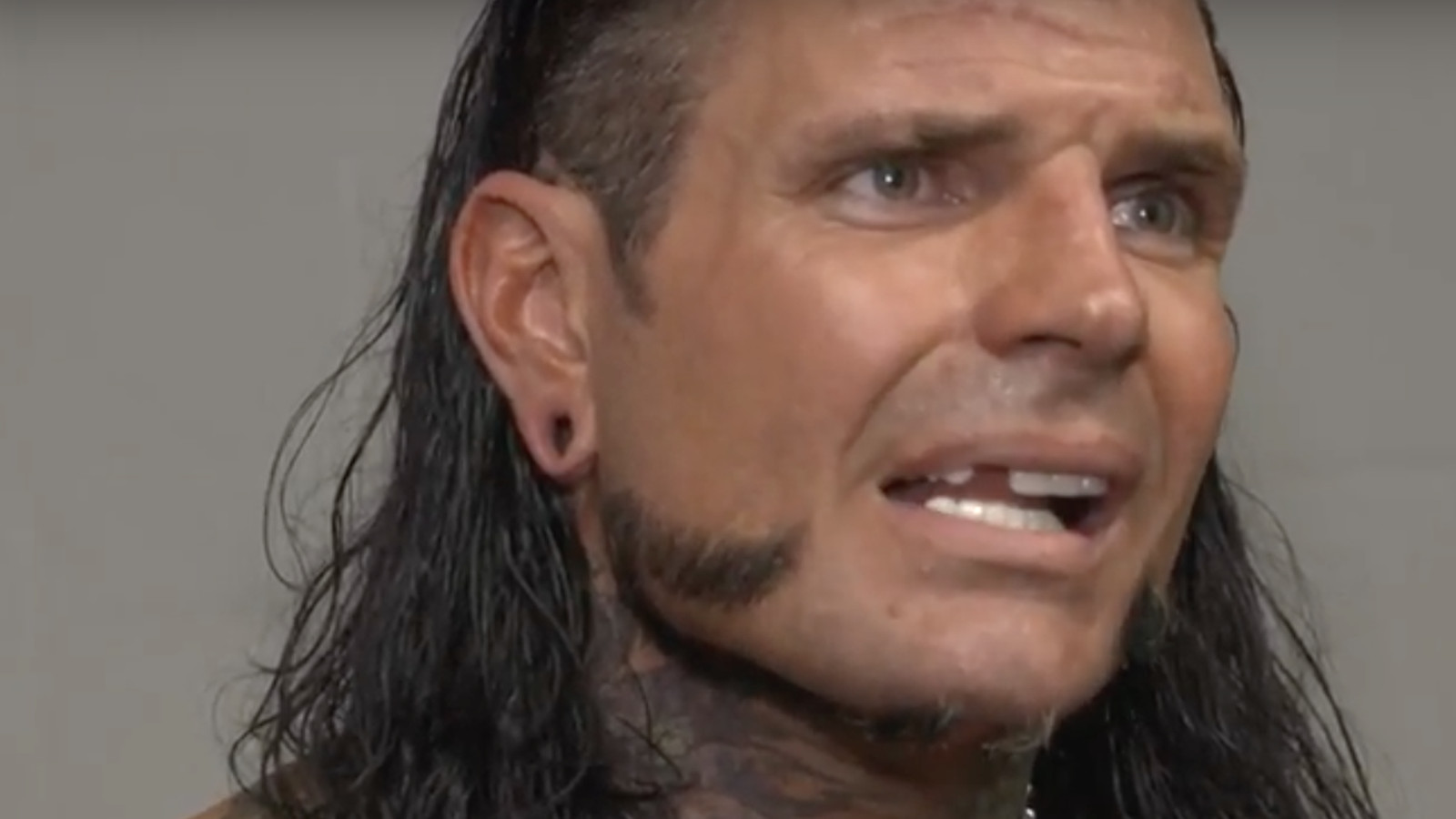 Jeff Hardy Got A Tooth Knocked Out So Let S Watch Doctors