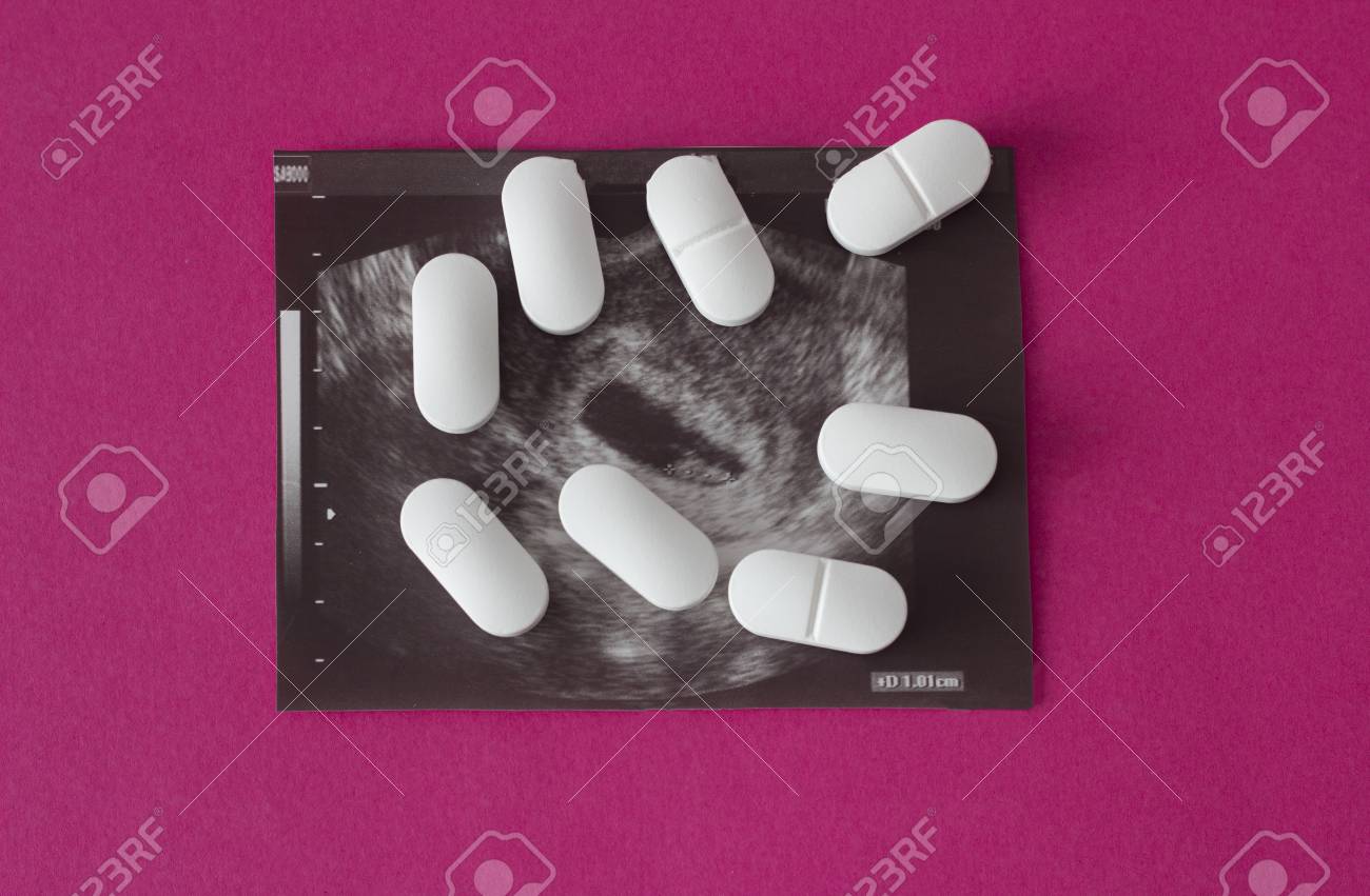 Uzi Of Pregnancy On A Pink Background And Pills Abortion Medical