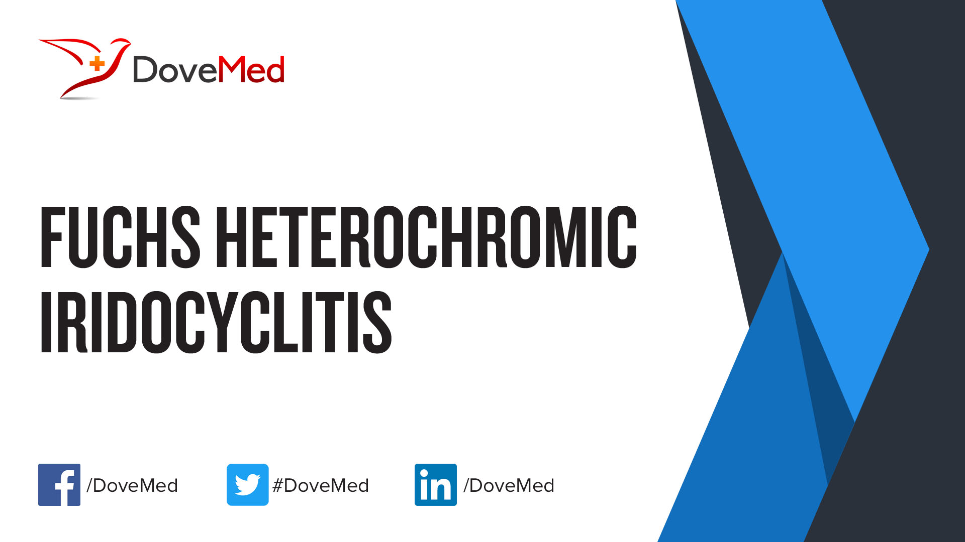 Fuchs Heterochromic Iridocyclitis
