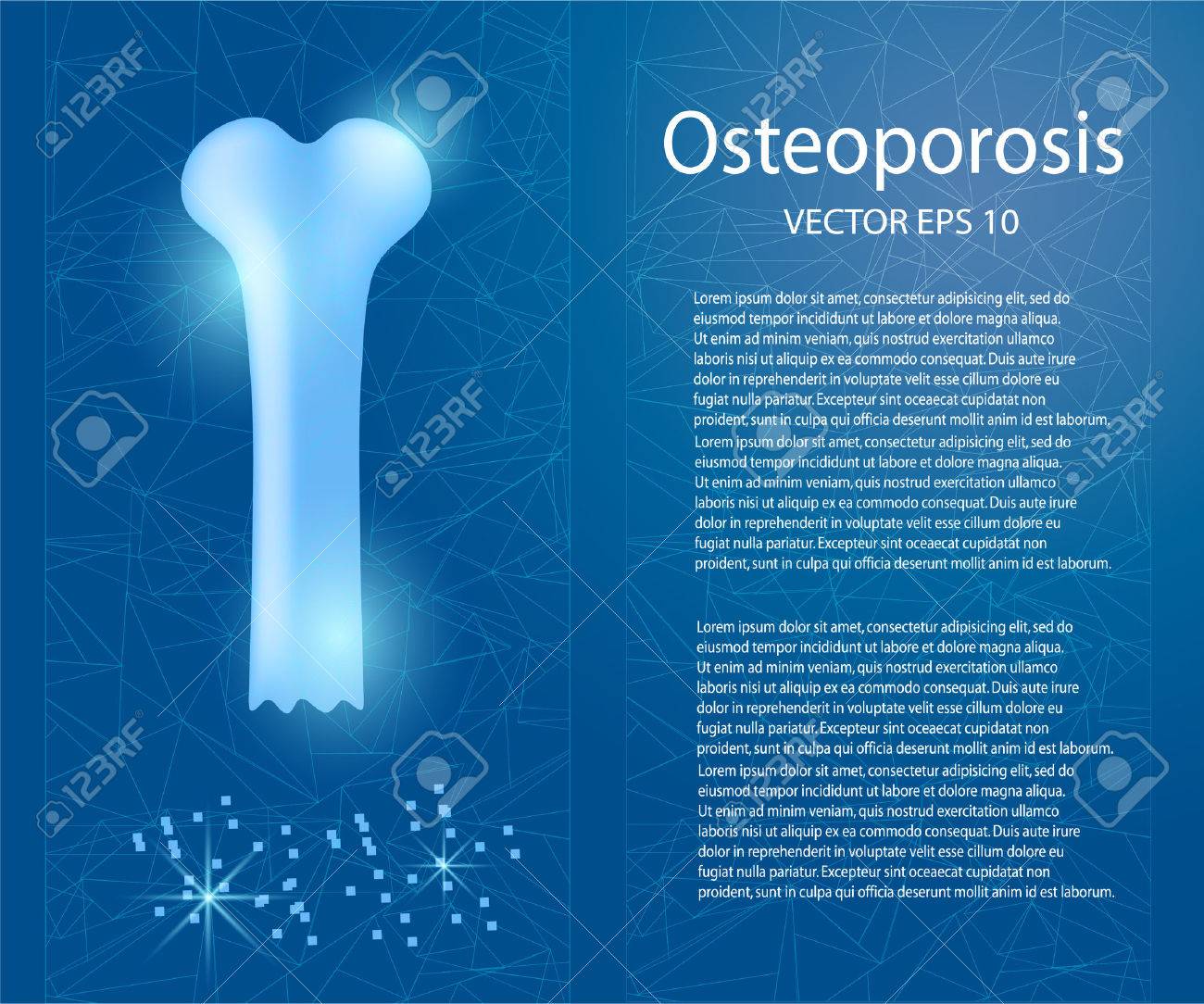 Osteoporosis On A Blue Background Royalty Cliparts Vectors