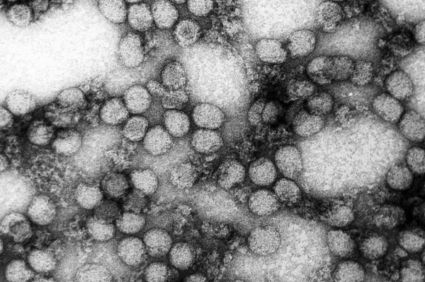 Lookfordiagnosis Comyellow Fever