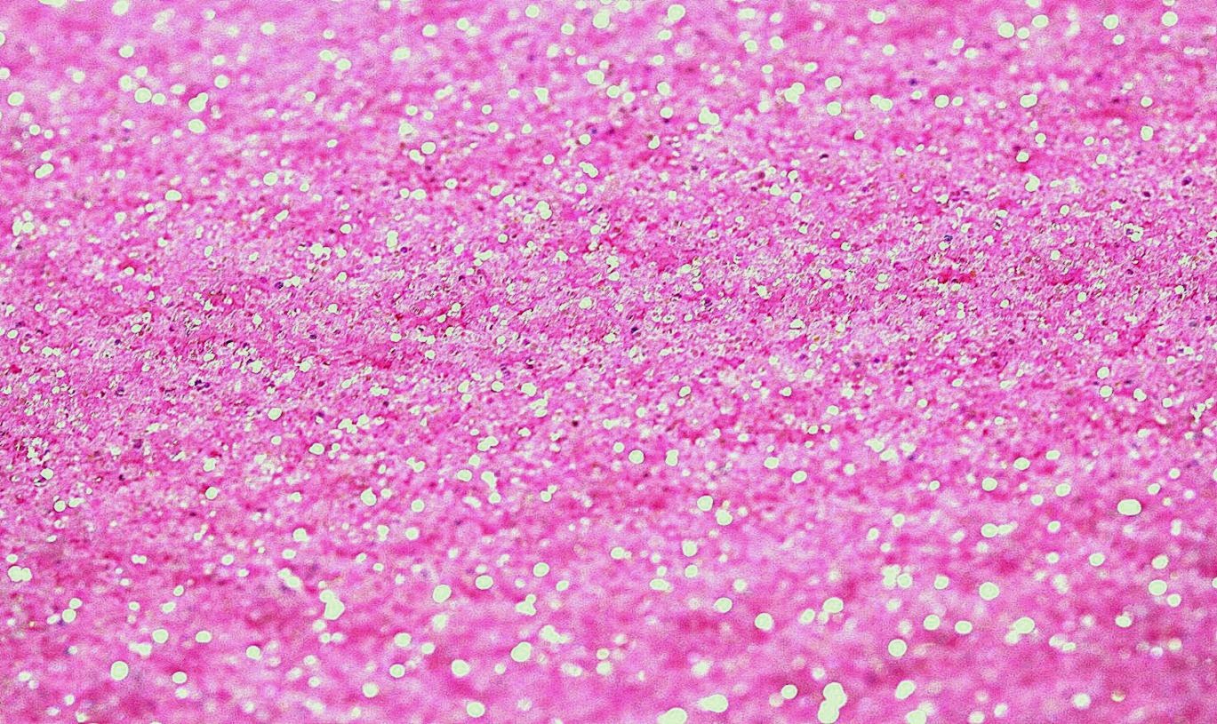 Pink Sparkle Wallpaper Cool HD