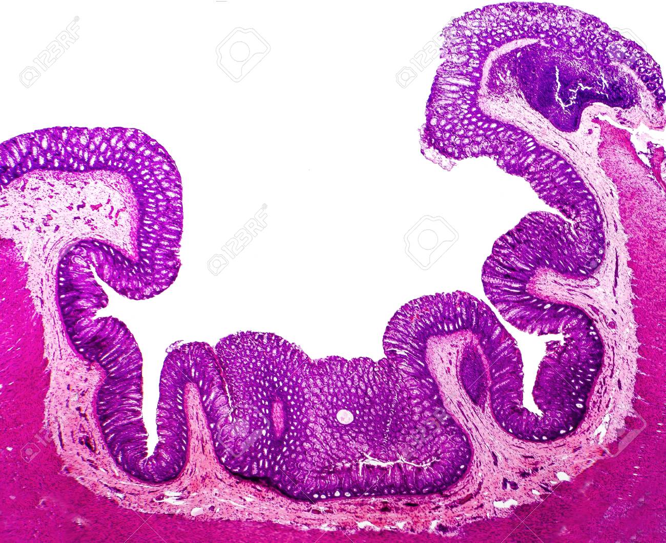 Histology Of Human Appendix Cross Section Micrograph Showing