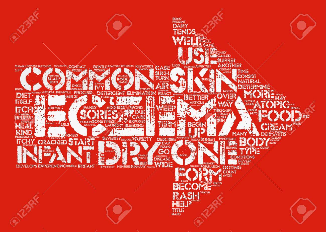 Eczema Or Atopic Text Background Word Cloud Concept Royalty