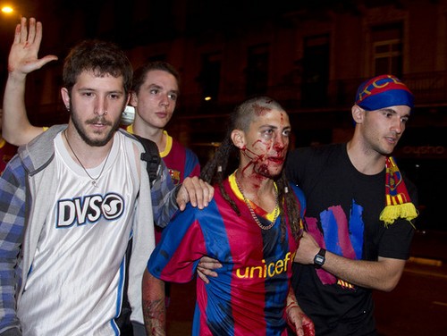Barcelona Defeat To Manchester United Fans Crazy