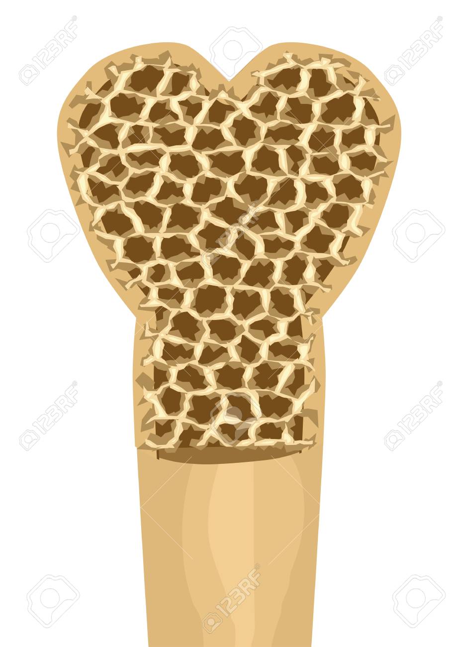 Osteoporosis Abstract Human Bone On White Background Royalty