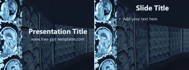 Radiology Ppt Template Powerpoint Templates