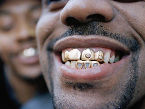 What The Heck Are Dental Grillz Hubs
