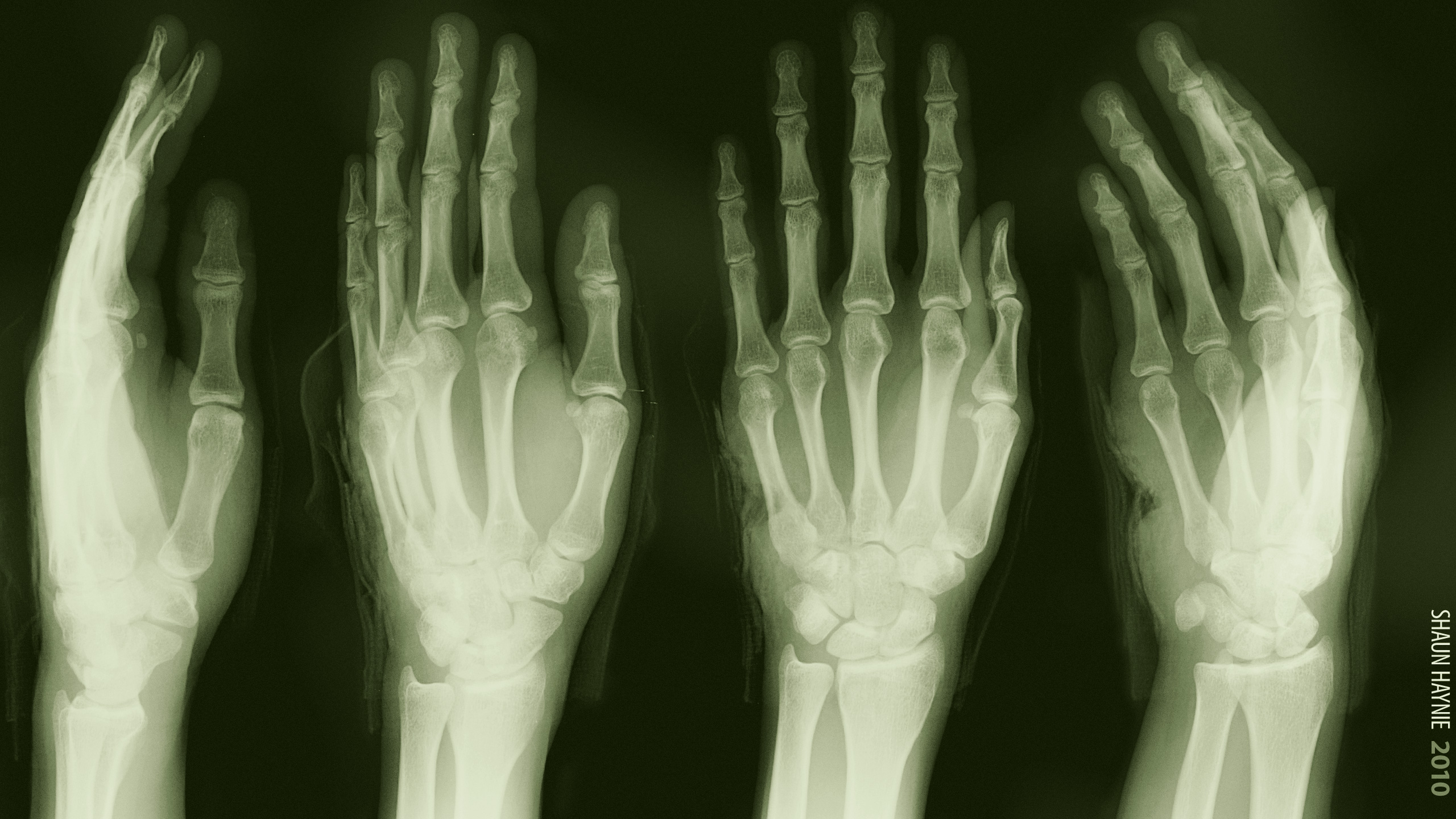 Dark Skeleton Medical Green Hand X Ray Wallpaper