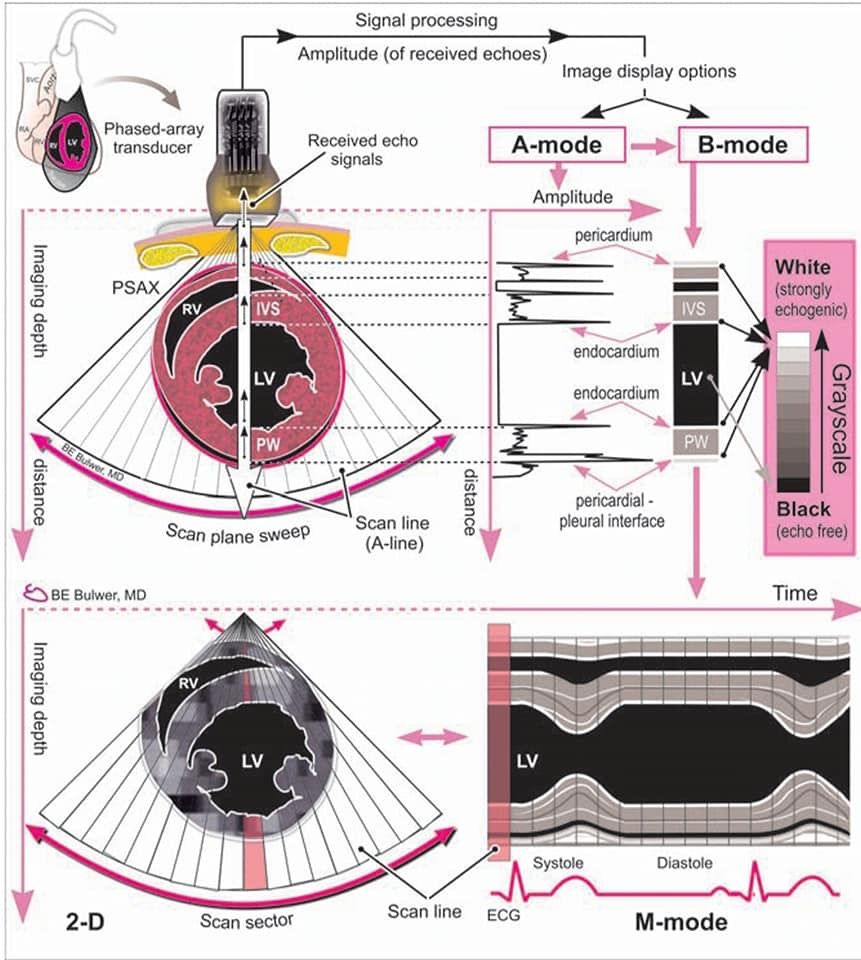Andres Sanchez On Echocardiography Cardiac Sonography