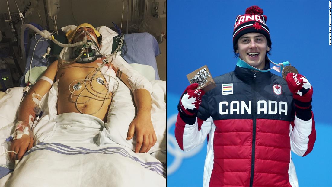 Canadian Snowboarder Mark Mcmorris Wins Olympic Bronze After Near